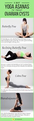 5 Best Yoga Asanas To Treat Ovarian Cysts Step By Step Guide Ovarian Cyst Yoga Asanas Ovarian