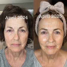 Has anyone tried Liv Schmidt's Skinni Societe? Any lasting success with it? 