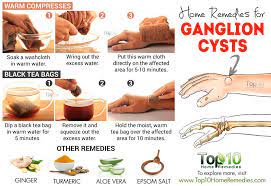 How do i get rid of a ganglion cyst fast? Home Remedies For Ganglion Cysts Top 10 Home Remedies