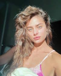Taylor Hill se ha convertido en la modelo más natural de Instagram. No es  la primera vez que muestra su acné y manda mensajes de aceptación. Todas  tenemos ojeras, acné, manchas... y