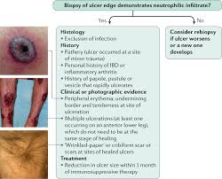 Image result for Pyoderma Gangrenosum