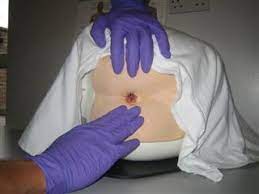 Rectal (Pr) Examination — Medistudents