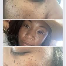 Skincare Near Me: Falls Church, VA