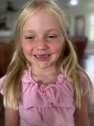 All he wanted for Christmas was his two front teeth. And Santa delivered!