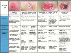 pin by allison on nurse inspiration in 2021 pressure ulcer wound care nursing wound healing nursing