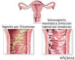 Flujo Vaginal Es Normal Tenerlo