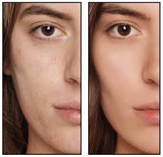 Spa Sciences BELLA 3-in-1 Diamond Microdermabrasion, Pore Extraction &  Micro Mister