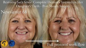 Newsletter 68 Restoring Jan's Smile: Complete Dentures Inspired by Her  Daughter's Teeth