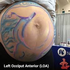 The left occiput anterior position is the most common, ideal fetal position (optimal foetal position). Spinning Babies On Twitter The Left Occiput Anterior Position Has The Reputation As The Best Fetal Position Learn Why It S Actually Just One Of The Best Positions To Help The Baby Be