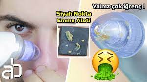 Yalniz Cok Igrenc Siyah Nokta Emme Aleti Cilt Bakimi Youtube