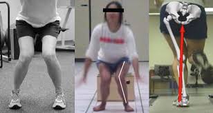 Caution in general about hip abduction: Differences In Hip Muscle Activation With Variations Of A Resisted Sidestepping Exercise