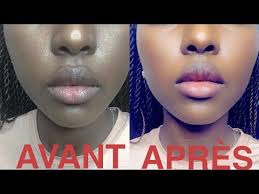 Astuce Beaute Cette Huile Fait Des Merveilles Youtube Astuces Beaute Tache Brune Visage Astuces Beaute Visage