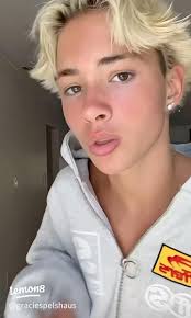 Elvis' New Leg Dance: Weight Bearing Triumph