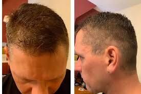 So it went a bit wrong': People share their hilarious efforts at lockdown  haircuts