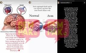 Beliau mula meraih kemasyhuran sebagai juara hero remaja 2011/2012 dan terkenal menerusi peranan sebagai watak utama sebagai dalam drama playboy itu suami aku sebagai raja. Tania Hudson Hidap Arteriovenous Malformation Avm Oi Jom