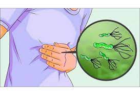 A common cause of peptic ulcers, h. Helicobacter Pylori How Dangerous Is This Infection