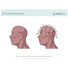 Eeg Electrode Placement