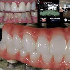 This Is What We Do At Adar Dental Laboratories We Change People S Lives For The Better Adardentalnetwork Pinhasa Dental Laboratory Dental Dental Implants