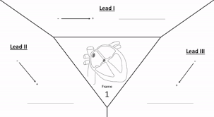 Electrocardiography Wikipedia