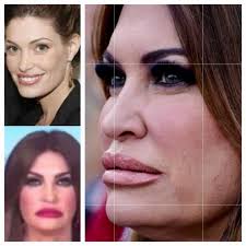 This is what bad plastic surgery and hate for others does to a person.