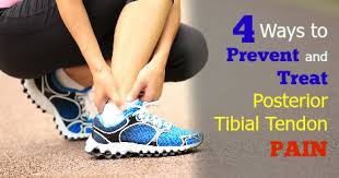 4 Ways To Prevent And Treat Posterior Tibial Tendonitis Runners Connect