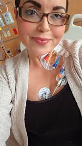 Hey everyone does any with neurological issues from sarcoidosis does your  feet and legs bother you to the point that like you don't want stand up or  move?! Also have weird burning