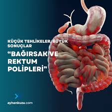 Ostomi |Stoma | Bağırsağın Torbaya Bağlanması