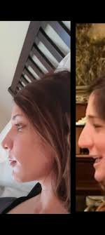 Happy Valentines Day from your favorite oral surgery team! ♥️ 🦷 ♥️