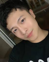 Trải qua 20 cuộc phẫu thuật sau tai nạn nghiêm trọng, Harry Lu vẫn chưa thể  tự tin với ngoại hình