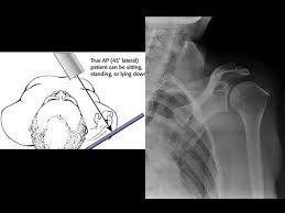 Image result for Shoulder Imaging