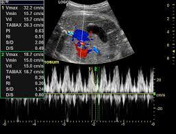 Normal obstetrics scan (third trimester singleton) | Radiology Case |  Radiopaedia.org