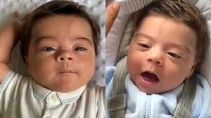 Newborn baby shocks family with incredible thick hair due to rare condition