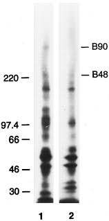 We did not find results for: Role Of The Golgi Apparatus In The Phosphorylation Of Apolipoprotein B Journal Of Biological Chemistry