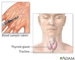 Image result for Thyroid Function Test