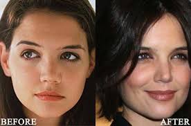 Mommy Makeover Photo Gallery Michele Shermak Md Plastic Surgery Photos Hair Implants Celebrity Surgery