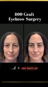 🏆What an honour to be nominated for the Top Doctors TO 2025 issue! Thank  you! 🙏 ✨Winners are determined based