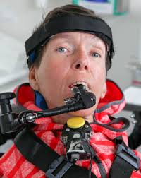 Objektivierung der Kaufunktion bei immobilen Probanden