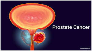 Although november (also known as movember for this matter) is the chosen month to raise awareness around all those health issues affecting men, march was the chosen month to educate the public about prostate cancer, which. Prostate Cancer Awareness Month