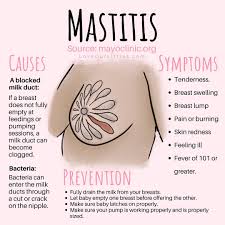 Image result for Mastitis