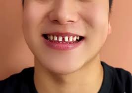 Appreciation for Unique Teeth