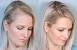 Post Pregnancy Hair Loss Meme