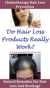 It is therefore recommended to avoid brushing wet hair. Pin On Treat Hairloss