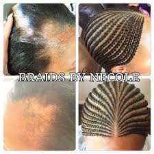 Braids By Necole This Here Is One Of My Beloved Clients Who Have Been Coming To Me For 15 Year Alopecia Hairstyles African Braids Hairstyles Grow Long Hair