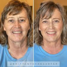 Seint makeup before and after results