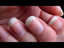 Pin On Cancer Symptoms