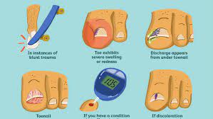 Pus coming out of it. When To Seek Treatment For Toenail Trauma