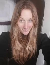 Woman whose face was plagued with weeping sores now has clear skin thanks  to 'miracle' cream