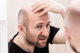 In this review, we provide the resources to the latest preclinical studies and a more det … New Stem Cell Based Topical Solution Helps Bald People Regrow Hair