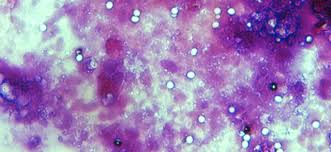 Cryptosporidium parvum is an apicomplexan zoonotic parasite recognized as the second three common species cryptosporidium parvum, giardia enterica and toxoplasma gondii can. Universitat Leipzig Kryptosporidien