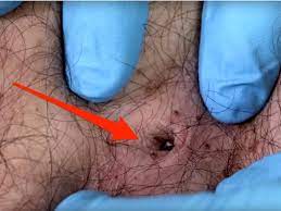 Grabbing his arm, she began chanting, going faster and faster. What You Need To Know About Navel Stones In The Belly Button